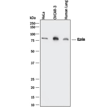 Western blot shows lysates of HeLa human cervical epithelial carcinoma cell line, OVCAR-3 human ovarian carcinoma cell line, and human lung tissue. PVDF membrane was probed with 0.2 µg/mL of Rabbit Anti-Human Ezrin Monoclonal Antibody (Catalog # MAB7239) followed by HRP-conjugated Anti-Rabbit IgG Secondary Antibody (Catalog # HAF008). A specific band was detected for Ezrin at approximately 80 kDa (as indicated). This experiment was conducted under reducing conditions and using Immunoblot Buffer Group 1.