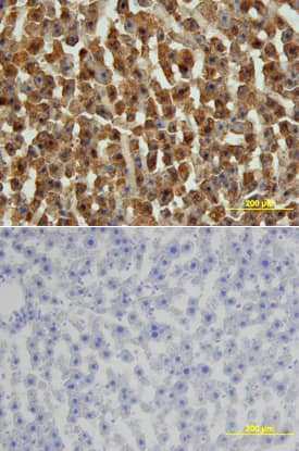 FABP1 was detected in perfusion fixed frozen sections of rat liver using Goat Anti-Human/Mouse/Rat FABP1 Antigen Affinity-purified Polyclonal Antibody (Catalog # AF1565) at 15 µg/mL overnight at 4 °C. Tissue was stained using the Anti-Goat HRP-DAB Cell & Tissue Staining Kit (brown; Catalog # CTS008) and counterstained with hematoxylin (blue). Lower panel shows a lack of labeling if primary antibodies are omitted and tissue is stained only with secondary antibody followed by incubation with detection reagents. View our protocol for Chromogenic IHC Staining of Frozen Tissue Sections.
