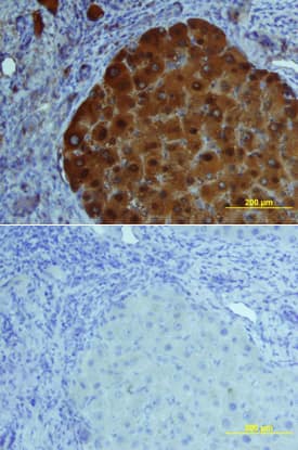 FABP1 was detected in immersion fixed paraffin-embedded sections of human liver using Goat Anti-Human/Mouse/Rat FABP1/L-FABP Antigen Affinity-purified Polyclonal Antibody (Catalog # AF2964) at 15 µg/mL overnight at 4 °C. Tissue was stained using the Anti-Goat HRP-DAB Cell & Tissue Staining Kit (brown; Catalog # CTS008) and counterstained with hematoxylin (blue). Lower panel shows a lack of labeling if primary antibodies are omitted and tissue is stained only with secondary antibody followed by incubation with detection reagents. View our protocol for Chromogenic IHC Staining of Paraffin-embedded Tissue Sections.