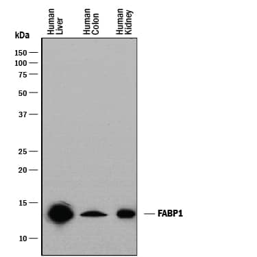 Western blot shows lysates of human liver tissue, human colon tissue, and human kidney tissue. PVDF membrane was probed with 0.25 µg/mL of Goat Anti-Human/ Mouse/Rat FABP1/L-FABP Antigen Affinity-purified Polyclonal Antibody (Catalog # AF2964) followed by HRP-conjugated Anti-Goat IgG Secondary Antibody (Catalog # HAF017). A specific band was detected for FABP1/L-FABP at approximately 14 kDa (as indicated). This experiment was conducted under reducing conditions and using Immunoblot Buffer Group 1.