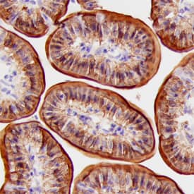 FABP1/L-FABP was detected in perfusion fixed frozen sections of mouse intestine using Sheep Anti-Human/Mouse/Rat FABP1/ L-FABP Antigen Affinity-purified Polyclonal Antibody (Catalog # AF7009) at 1.7 µg/mL overnight at 4 °C. Tissue was stained using the Anti-Sheep HRP-DAB Cell & Tissue Staining Kit (brown; Catalog # CTS019) and counterstained with hematoxylin (blue). Specific staining was localized to apical portion of epithelial cells. View our protocol for Chromogenic IHC Staining of Frozen Tissue Sections.