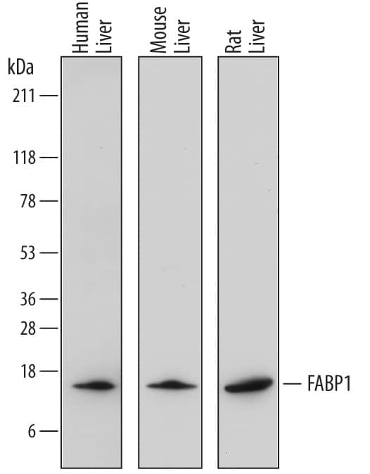 Western blot shows lysates of human liver tissue, mouse liver tissue, and rat liver tissue. PVDF membrane was probed with 0.1 µg/mL of Sheep Anti-Human/Mouse/Rat FABP1/L-FABP Antigen Affinity-purified Polyclonal Antibody (Catalog # AF7009) followed by HRP-conjugated Anti-Sheep IgG Secondary Antibody (Catalog # HAF016). A specific band was detected for FABP1/L-FABP at approximately 14 kDa (as indicated). This experiment was conducted under reducing conditions and using Immunoblot Buffer Group 1.
