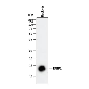 Western blot shows lysate of rat liver tissue. PVDF membrane was probed with 2 µg/mL of Mouse Anti-Mouse/Rat FABP1/L-FABP Monoclonal Antibody (Catalog # MAB1565) followed by HRP-conjugated Anti-Mouse IgG Secondary Antibody (Catalog # HAF018). A specific band was detected for FABP1/L-FABP at approximately 13 kDa (as indicated). This experiment was conducted under reducing conditions and using Immunoblot Buffer Group 1.