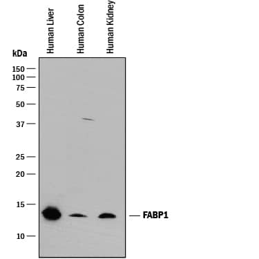 Western blot shows lysates of human liver tissue, human colon tissue, and human kidney tissue. PVDF membrane was probed with 0.25 µg/mL of Mouse Anti-Human/Mouse/Rat FABP1/L-FABP Monoclonal Antibody (Catalog # MAB29641) followed by HRP-conjugated Anti-Mouse IgG Secondary Antibody (Catalog # HAF018). A specific band was detected for FABP1/ L-FABP at approximately 14 kDa (as indicated). This experiment was conducted under reducing conditions and using Immunoblot Buffer Group 1.
