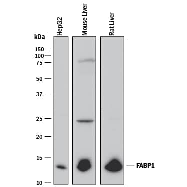 Western blot shows lysates of HepG2 human hepatocellular carcinoma cell line, mouse liver tissue, and rat liver tissue. PVDF membrane was probed with 0.25 µg/mL of Mouse Anti-Human/Mouse/Rat FABP1/ L-FABP Monoclonal Antibody (Catalog # MAB29641) followed by HRP-conjugated Anti-Mouse IgG Secondary Antibody (Catalog # HAF018). A specific band was detected for FABP1/L-FABP at approximately 14 kDa (as indicated). This experiment was conducted under reducing conditions and using Immunoblot Buffer Group 1.