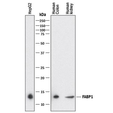 Western blot shows lysates of HepG2 human hepatocellular carcinoma cell line, human colon tissue, and human kidney tissue. PVDF membrane was probed with 2 µg/mL of Mouse Anti-Human FABP1/L-FABP Monoclonal Antibody (Catalog # MAB29644) followed by HRP-conjugated Anti-Mouse IgG Secondary Antibody (Catalog # HAF018). A specific band was detected for FABP1/L-FABP at approximately 14 kDa (as indicated). This experiment was conducted under reducing conditions and using Immunoblot Buffer Group 1.