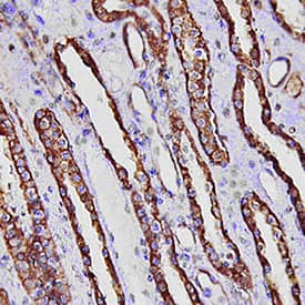 FABP1/L-FABP was detected in immersion fixed paraffin-embedded sections of human kidney using Mouse Anti-Human/Mouse/Rat FABP1/L-FABP Monoclonal Antibody (Catalog # MAB2964) at 15 µg/mL overnight at 4 °C. Tissue was stained using the Anti-Mouse HRP-DAB Cell & Tissue Staining Kit (brown; Catalog # CTS002) and counterstained with hematoxylin (blue). Specific staining was localized to convoluted tubules. View our protocol for Chromogenic IHC Staining of Paraffin-embedded Tissue Sections.