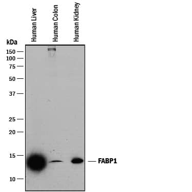 Western blot shows lysates of human liver tissue, human colon tissue, and human kidney tissue. PVDF membrane was probed with 0.25 µg/mL of Mouse Anti-Human/Mouse/Rat FABP1/L-FABP Monoclonal Antibody (Catalog # MAB2964) followed by HRP-conjugated Anti-Mouse IgG Secondary Antibody (Catalog # HAF018). A specific band was detected for FABP1/ L-FABP at approximately 14 kDa (as indicated). This experiment was conducted under reducing conditions and using Immunoblot Buffer Group 1.
