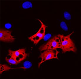FABP2/I-FABP was detected in immersion fixed rat mesenchymal stem cells differentiated to adipocytes using Goat Anti-Mouse/Rat FABP2/I-FABP Antigen Affinity-purified Polyclonal Antibody (Catalog # AF1486) at 10 µg/mL for 3 hours at room temperature. Cells were stained using the NorthernLights™ 557-conjugated Anti-Goat IgG Secondary Antibody (red; Catalog # NL001) and counterstained with DAPI (blue). Specific staining was localized to cytoplasm. View our protocol for Fluorescent ICC Staining of Stem Cells on Coverslips.
