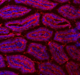 FABP2/I-FABP was detected in immersion fixed frozen sections of adult mouse intestine using Goat Anti-Mouse/Rat FABP2/I-FABP Antigen Affinity-purified Polyclonal Antibody (Catalog # AF1486) at 10 µg/mL overnight at 4 °C. Tissue was stained using the NorthernLights™ 557-conjugated Anti-Goat IgG Secondary Antibody (red; Catalog # NL001) and counterstained with DAPI (blue). Specific staining was localized to intestinal epithelia. View our protocol for Fluorescent IHC Staining of Frozen Tissue Sections.