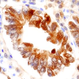 FABP2/I-FABP was detected in immersion fixed paraffin-embedded sections of human small intestine tissue using Goat Anti-Human FABP2/I-FABP Antigen Affinity-purified Polyclonal Antibody (Catalog # AF3078) at 0.3 µg/mL overnight at 4 °C. Tissue was stained using the Anti-Goat HRP-DAB Cell & Tissue Staining Kit (brown; Catalog # CTS008) and counterstained with hematoxylin (blue). Specific staining was localized to the nucleus and cytoplasm in epithelial cells.(6,7)View our protocol for IHC Staining with VisUCyte HRP Polymer Detection Reagents.