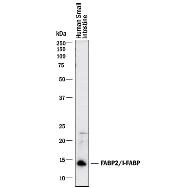 Western blot shows lysates of human small intestine tissue. PVDF membrane was probed with 1 µg/mL of Goat Anti-Human FABP2/I-FABP Antigen Affinity-purified Polyclonal Antibody (Catalog # AF3078) followed by HRP-conjugated Anti-Goat IgG Secondary Antibody (Catalog # HAF017). A specific band was detected for FABP2/I-FABP at approximately 14 kDa (as indicated). This experiment was conducted under reducing conditions and using Immunoblot Buffer Group 1.