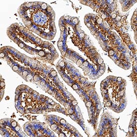 FABP2/I-FABP was detected in perfusion fixed paraffin-embedded sections of human small intestine using Mouse Anti-Human/Mouse FABP2/I-FABP Monoclonal Antibody (Catalog # MAB30781) at 5 µg/mL for 1 hour at room temperature followed by incubation with the Anti-Mouse IgG VisUCyte™ HRP Polymer Antibody (Catalog # VC001). Tissue was stained using DAB (brown) and counterstained with hematoxylin (blue). Specific staining was localized to cytoplasm in epithelial cells. View our protocol for IHC Staining with VisUCyte HRP Polymer Detection Reagents.