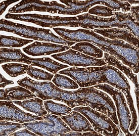 FABP2/I-FABP was detected in immersion fixed paraffin-embedded sections of human small intestine using Mouse Anti-Human/Mouse/Rat FABP2/I-FABP Monoclonal Antibody (Catalog # MAB30782) at 5 µg/mL for 1 hour at room temperature followed by incubation with the Anti-Mouse IgG VisUCyte™ HRP Polymer Antibody (Catalog # VC001). Tissue was stained using DAB (brown) and counterstained with hematoxylin (blue). Specific staining was localized to cytoplasm in epithelial cells. View our protocol for IHC Staining with VisUCyte HRP Polymer Detection Reagents.