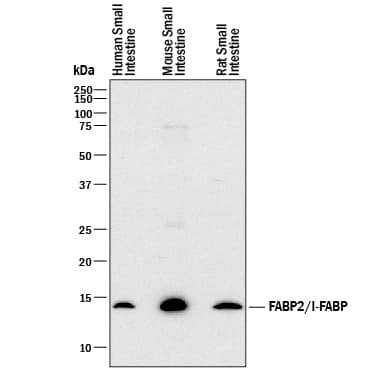Western blot shows lysates of human small intestine tissue, mouse small intestine tissue, and rat small intestine tissue. PVDF membrane was probed with 0.5 µg/mL of Mouse Anti-Human/Mouse/Rat FABP2/I-FABP Monoclonal Antibody (Catalog # MAB30782) followed by HRP-conjugated Anti-Mouse IgG Secondary Antibody (Catalog # HAF018). A specific band was detected for FABP2/I-FABP at approximately 15 kDa (as indicated). This experiment was conducted under reducing conditions and using Immunoblot Buffer Group 1.