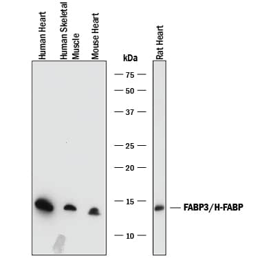 Western Blot FABP3/H-FABP Antibody [Unconjugated]