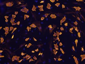 FABP4 was detected in immersion fixed rat mesenchymal stem cells differentiated to adipocytes using Goat Anti-Mouse/Rat FABP4 Antigen Affinity-purified Polyclonal Antibody (Catalog # AF1443) at 10 µg/mL for 3 hours at room temperature. Cells were stained using the NorthernLights™ 557-conjugated Anti-Goat IgG Secondary Antibody (yellow; Catalog # NL001) and counterstained with DAPI (blue). View our protocol for Fluorescent ICC Staining of Cells on Coverslips.