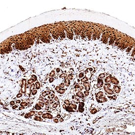 FABP5/E-FABP was detected in immersion fixed paraffin-embedded sections of mouse skin (ear) tissue using Goat Anti-Human/Mouse/Rat FABP5/E-FABP Antigen Affinity-purified Polyclonal Antibody (Catalog # AF1476) at 3 µg/mL for 1 hour at room temperature followed by incubation with the Anti-Goat IgG VisUCyte™ HRP Polymer Antibody (VC004). Before incubation with the primary antibody, tissue was subjected to heat-induced epitope retrieval using Antigen Retrieval Reagent-Basic (CTS013). Tissue was stained using DAB (brown) and counterstained with hematoxylin (blue). Specific staining was localized to cell nuclei. View our protocol for IHC Staining with VisUCyte HRP Polymer Detection Reagents.