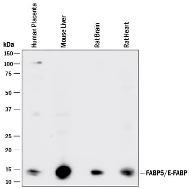 Western Blot FABP5/E-FABP Antibody [Unconjugated]