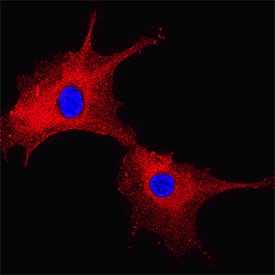 Immunocytochemistry FABP5/E-FABP Antibody [Unconjugated]
