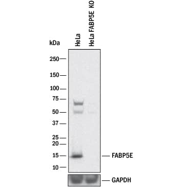 Knockout Validated FABP5/E-FABP Antibody [Unconjugated]