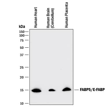 Western Blot FABP5/E-FABP Antibody [Unconjugated]