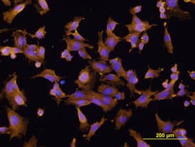 Immunocytochemistry FABP5/E-FABP Antibody (311215) [Unconjugated]