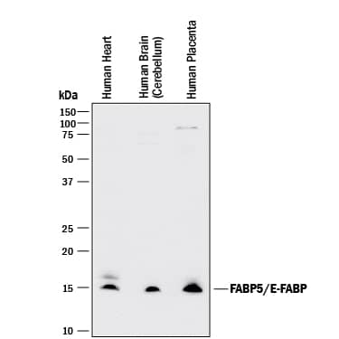 Western Blot FABP5/E-FABP Antibody (311215) [Unconjugated]