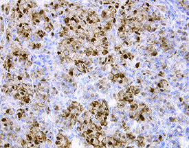 Immunohistochemistry FABP7/B-FABP Antibody [Unconjugated]