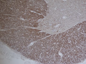 Immunohistochemistry FABP8/M-FABP/Myelin P2 Protein Antibody