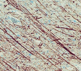 Immunohistochemistry FABP8/M-FABP/Myelin P2 Protein Antibody