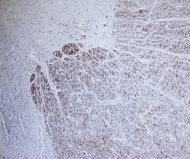FABP8/M-FABP was detected in immersion fixed paraffin-embedded sections of human spinal cord using using Mouse Anti-Human FABP8/ M-FABP Mono-clonal Antibody (Catalog # MAB5866) at 15 µg/mL overnight at 4 °C. Before incubation with the primary antibody, tissue was subjected to heat-induced epitope retrieval using Antigen Retrieval Reagent-Basic (Catalog # CTS013). Tissue was stained using the Anti-Mouse HRP-DAB Cell & Tissue Staining Kit (brown; Catalog # CTS002) and counter-stained with hematoxylin (blue). Specific staining was localized to white matter. View our protocol for Chromogenic IHC Staining of Paraffin-embedded Tissue Sections.