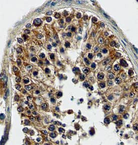 Immunohistochemistry FABP9/T-FABP Antibody