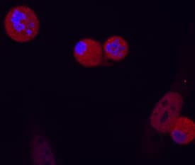 <b>Biological Strategies Validation. </b>FADD phosphorylated at S194 was detected in immersion fixed HeLa human cervical epithelial carcinoma cell line stimulated with nocadazole using Mouse Anti-Human Phospho-FADD (S194) Monoclonal Antibody (Catalog # MAB7047) at 10 µg/mL for 3 hours at room temperature. Cells were stained using the NorthernLights™ 557-conjugated Anti-Mouse IgG Secondary Antibody (red; Catalog # NL007) and counterstained with DAPI (blue). Specific staining was localized to nuclei. View our protocol for Fluorescent ICC Staining of Cells on Coverslips.