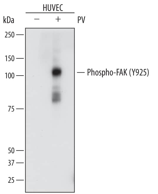 Western blot shows lysates of HeLa human cervical epithelial carcinoma cell line untreated (-) or treated (+) with 1 mM Pervanadate (PV) for 5 minutes. PVDF membrane was probed with 0.5 µg/mL of Rabbit Anti-Human Phospho-FAK (Y925) Antigen Affinity-purified Polyclonal Antibody (Catalog # AF44671) followed by HRP-conjugated Anti-Rabbit IgG Secondary Antibody (Catalog # HAF008). A specific band was detected for Phospho-FAK (Y925) at approximately 125 kDa (as indicated). This experiment was conducted under reducing conditions and using Immunoblot Buffer Group 1.