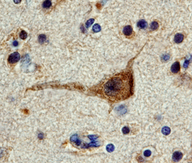FAK was detected in immersion fixed paraffin-embedded sections of human brain (hippocampus) using 3 µg/mL Human/Mouse/Rat FAK Antigen Affinity-purified Polyclonal Antibody (Catalog # AF4467) overnight at 4 °C. Tissue was stained with the Anti-Sheep HRP-DAB Cell & Tissue Staining Kit (brown; Catalog # CTS019) and counterstained with hematoxylin (blue). View our protocol for Chromogenic IHC Staining of Paraffin-embedded Tissue Sections.