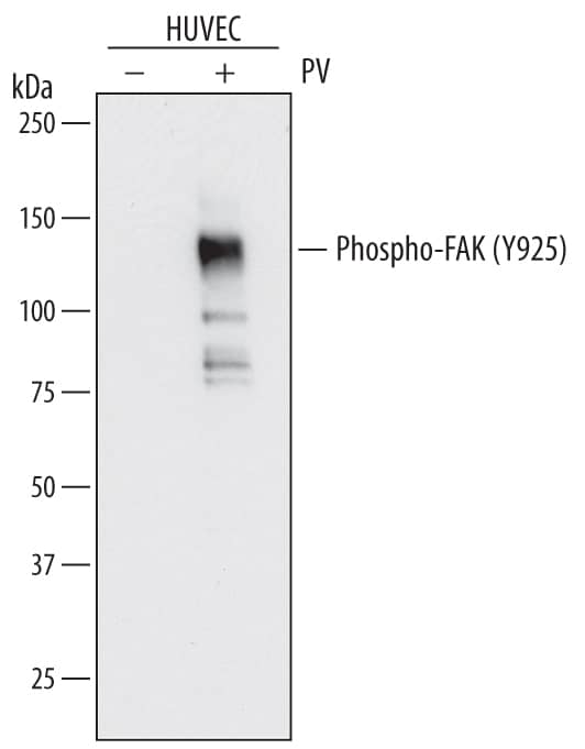 Western blot shows lysates of HUVEC human umbilical vein endothelial cells untreated (-) or treated (+) with 1 mM Pervanadate (PV) for 5 minutes. PVDF membrane was probed with 0.5 µg/mL of Mouse Anti-Human Phospho-FAK (Y925) Monoclonal Antibody (Catalog # MAB44671) followed by HRP-conjugated Anti-Mouse IgG Secondary Antibody (Catalog # HAF007). A specific band was detected for Phospho-FAK (Y925) at approximately 125 kDa (as indicated). This experiment was conducted under reducing conditions and using Immunoblot Buffer Group 1.