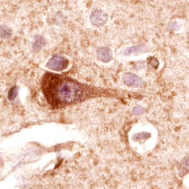 FAK was detected in immersion fixed paraffin-embedded sections of human brain (hippocampus) using Human FAK Monoclonal Antibody (Catalog # MAB4467) at 25 µg/mL overnight at 4 °C. Tissue was stained using the Anti-Mouse HRP-DAB Cell & Tissue Staining Kit (brown; Catalog # CTS002) and counterstained with hematoxylin (blue). View our protocol for Chromogenic IHC Staining of Paraffin-embedded Tissue Sections.