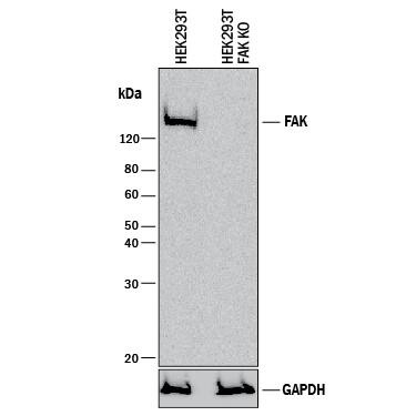 <b>Genetic Strategies Validation. </b>Western blot shows lysates of HEK293T human embryonic kidney parental cell line and FAK knockout HEK293T cell line (KO). PVDF membrane was probed with 2 µg/mL of Mouse Anti-Human FAK Monoclonal Antibody (Catalog # MAB4467) followed by HRP-conjugated Anti-Mouse IgG Secondary Antibody (HAF018). A specific band was detected for FAK at approximately 135 kDa (as indicated) in the parental HEK293T cell line, but is not detectable in knockout HEK293T cell line. GAPDH (MAB5718) is shown as a loading control. This experiment was conducted under reducing conditions and using Immunoblot Buffer Group 1.