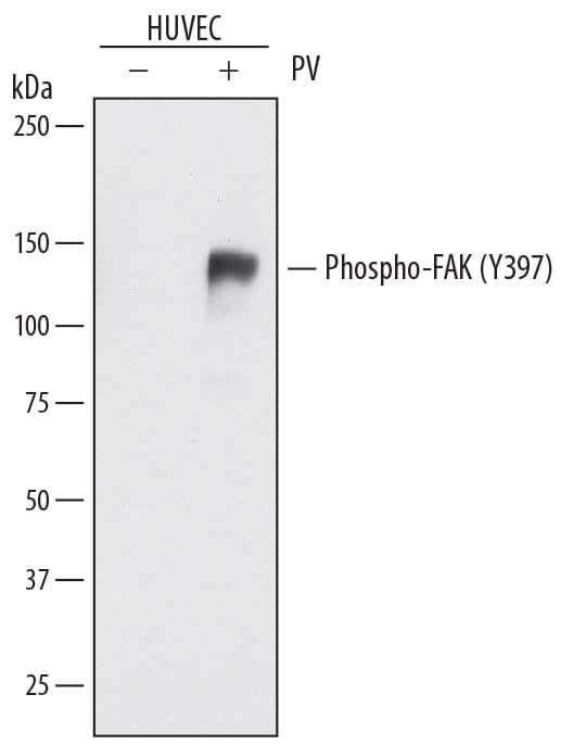 Western blot shows lysates of HUVEC human umbilical vein endothelial cells untreated (-) or treated (+) with 0.1 mM Pervanadate (PV) for 10 minutes. PVDF membrane was probed with 0.5 µg/mL of Rat Anti-Human Phospho-FAK (Y397) Monoclonal Antibody (Catalog # MAB4528) followed by HRP-conjugated Anti-Rat IgG Secondary Antibody (Catalog # HAF005). A specific band was detected for Phospho-FAK (Y397) at approximately 150 kDa (as indicated). This experiment was conducted under reducing conditions and using Immunoblot Buffer Group 1.