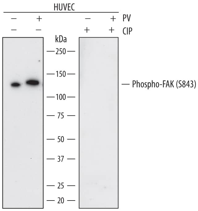 Western blot shows lysates of HUVEC human umbilical vein endothelial cells untreated (-) or treated (+) with 1 mM Pervanadate (PV) 5 minutes and 300 U/mL CIP for 1 hour. PVDF membrane was probed with 0.5 µg/mL of Mouse Anti-Human Phospho-FAK (S843) Monoclonal Antibody (Catalog # MAB7298) followed by HRP-conjugated Anti-Mouse IgG Secondary Antibody (Catalog # HAF007). A specific band was detected for Phospho-FAK (S843) at approximately 125 kDa (as indicated). This experiment was conducted under reducing conditions and using Immunoblot Buffer Group 1.