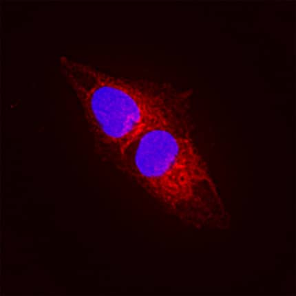 FAM20B was detected in immersion fixed SH-SY5Y human neuroblastoma cell line using Mouse Anti-Human FAM20B Monoclonal Antibody (Catalog # MAB84272) at 8 µg/mL for 3 hours at room temperature. Cells were stained using the NorthernLights™ 557-conjugated Anti-Mouse IgG Secondary Antibody (red; Catalog # NL007) and counterstained with DAPI (blue). Specific staining was localized to cytoplasm. View our protocol for Fluorescent ICC Staining of Cells on Coverslips.