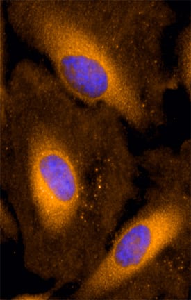 Immunocytochemistry FATP1/SLC27A1 Antibody (308420) [Unconjugated]