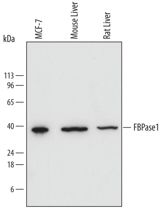 Western blot shows lysates of MCF-7 human breast cancer cell line, mouse liver tissue, and rat liver tissue. PVDF membrane was probed with 0.2 µg/mL of Sheep Anti-Human/Mouse/Rat FBPase 1 Antigen Affinity-purified Polyclonal Antibody (Catalog # AF7285) followed by HRP-conjugated Anti-Sheep IgG Secondary Antibody (Catalog # HAF016). A specific band was detected for FBPase 1 at approximately 37 kDa (as indicated). This experiment was conducted under reducing conditions and using Immunoblot Buffer Group 1.