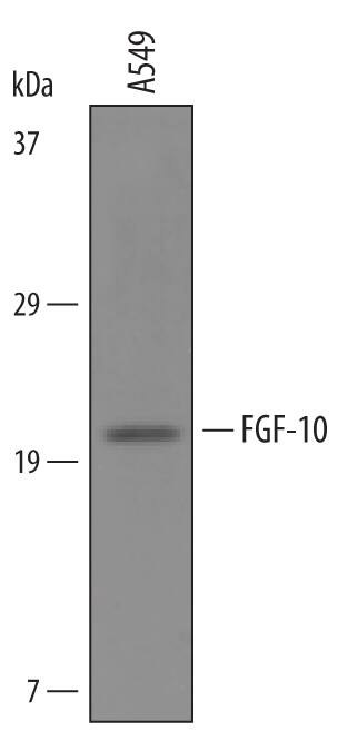Western Blot FGF-10 Antibody [Unconjugated]