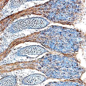 FGF-15 was detected in immersion fixed frozen sections of mouse embryo (E15) using Sheep Anti-Mouse FGF-15 Antigen Affinity-purified Polyclonal Antibody (Catalog # AF6755) at 15 µg/mL overnight at 4 °C. Tissue was stained using the Anti-Sheep HRP-DAB Cell & Tissue Staining Kit (brown; Catalog # CTS019) and counterstained with hematoxylin (blue). Specific staining was localized to the processes of dorsal root ganglia neurons. View our protocol for Chromogenic IHC Staining of Frozen Tissue Sections.
