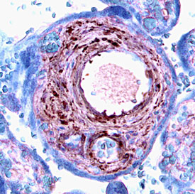 FGF-9 was detected in immersion fixed paraffin-embedded sections of human placenta using 5 µg/mL Goat Anti-Human FGF-9 Antigen Affinity-purified Polyclonal Antibody (Catalog # AF-273-NA) overnight at 4 °C. Tissue was stained with the Anti-Goat HRP-AEC Cell & Tissue Staining Kit (red; Catalog # CTS009) and counterstained with hematoxylin (blue). View our protocol for Chromogenic IHC Staining of Paraffin-embedded Tissue Sections.
