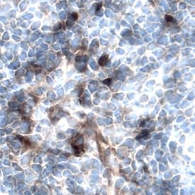 FGF-BP was detected in perfusion fixed frozen sections of rat thymus using Rat FGF-BP Antigen Affinity-purified Polyclonal Antibody (Catalog # AF1413) at 5 µg/mL overnight at 4 °C. Tissue was stained using the Anti-Goat HRP-DAB Cell & Tissue Staining Kit (brown; Catalog # CTS008) and counterstained with hematoxylin (blue). Specific labeling was localized to the cytoplasm of lymphocytes. View our protocol for Chromogenic IHC Staining of Frozen Tissue Sections.