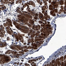 Immunohistochemistry FGF-16 Antibody [Unconjugated]