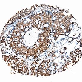 Immunohistochemistry FGF-19 Antibody (117601) [Unconjugated]